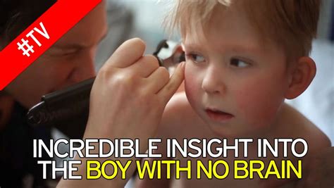 the boy with no brain full documentary